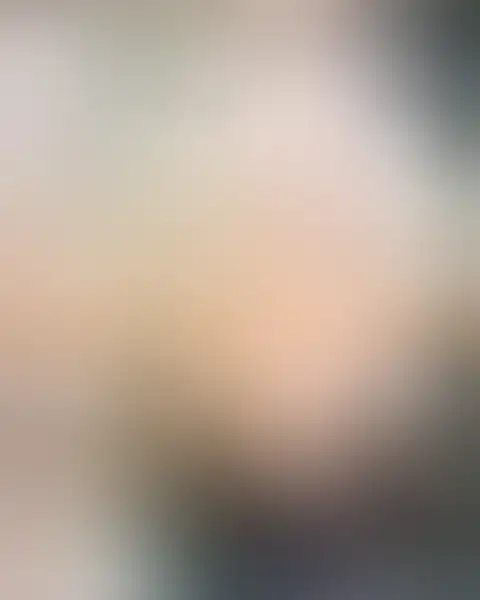 Blurred preview of a real before & after case
